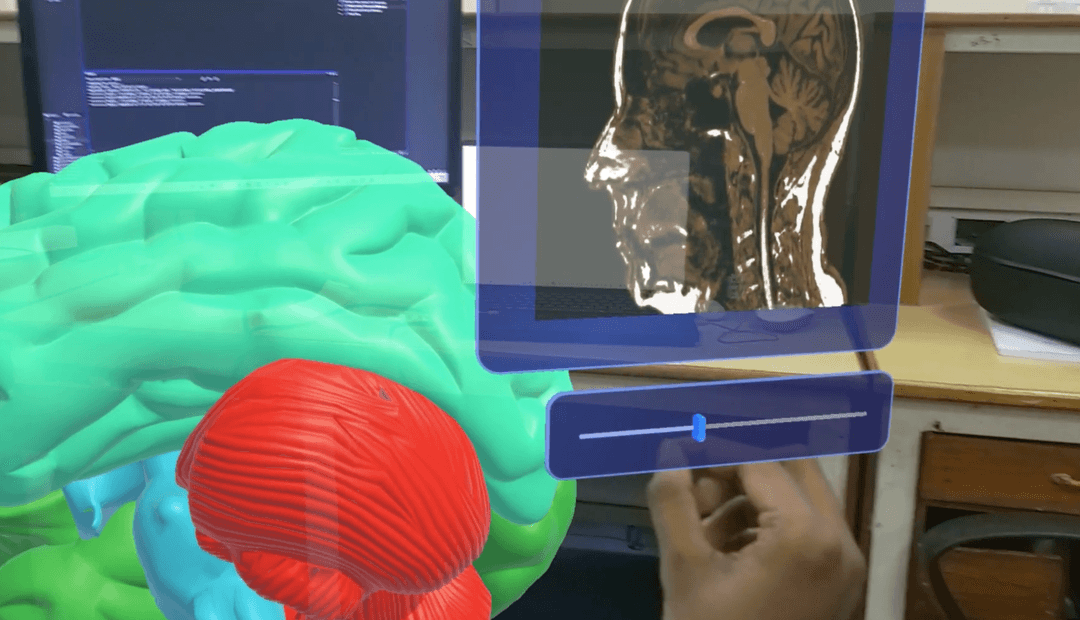 Alzheimer's Detector & AR Classifier